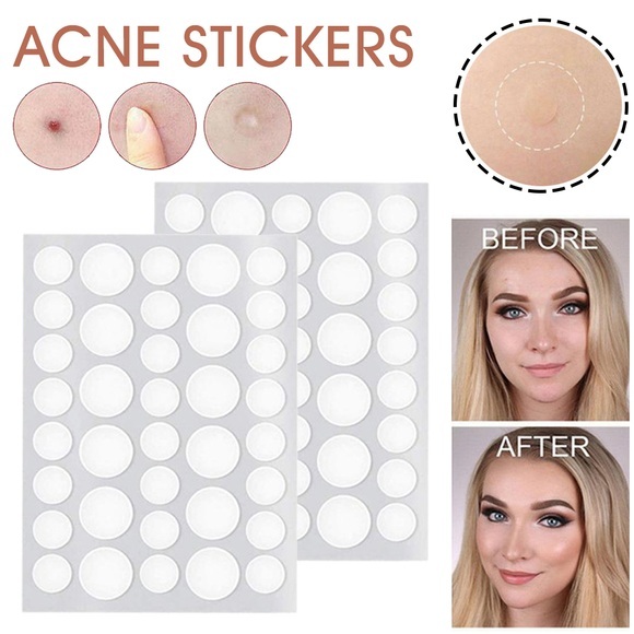 Invisible Acne Spot Treatment Stickers with Tea Tree Oil Absorbing Cover Patches Face Acne Pimple Remover Patches