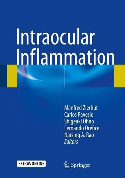 Intraocular Inflammation