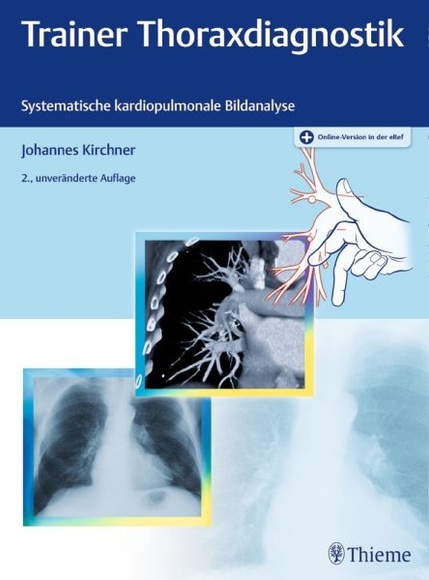 Trainer Thoraxdiagnostik, m. 1 Buch, m. 1 E-Book