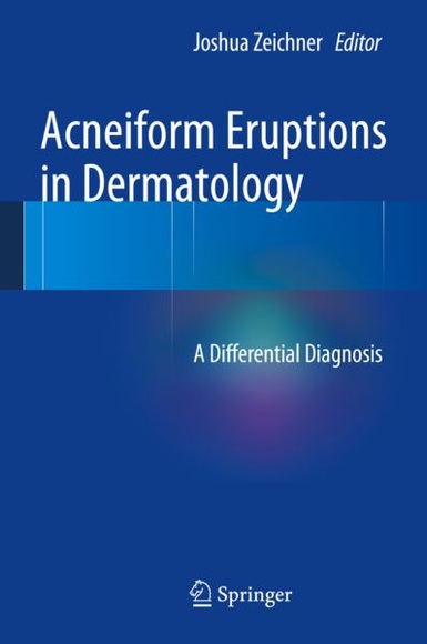 Acneiform Eruptions in Dermatology