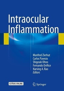 SPRINGER, Intraocular Inflammation, 