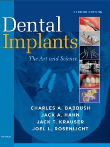 Elsevier HealthScience EN, Dental Implants, 