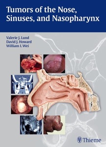undefined, Tumors of the Nose, Sinuses and Nasopharynx, Tumors of the Nose, Sinuses and Nasopharynx
