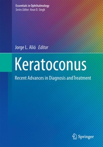 undefined, Keratoconus, 