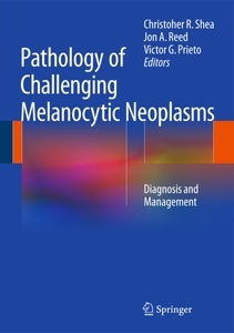 undefined, Pathology of Challenging Melanocytic Neoplasms, 