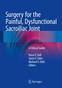 undefined, Surgery for the Painful, Dysfunctional Sacroiliac Joint, Surgery for the Painful, Dysfunctional Sacroiliac Joint