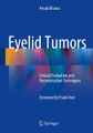 SPRINGER, Eyelid Tumors